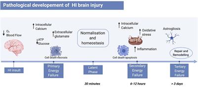 Current Therapies for Neonatal Hypoxic–Ischaemic and Infection-Sensitised Hypoxic–Ischaemic Brain Damage